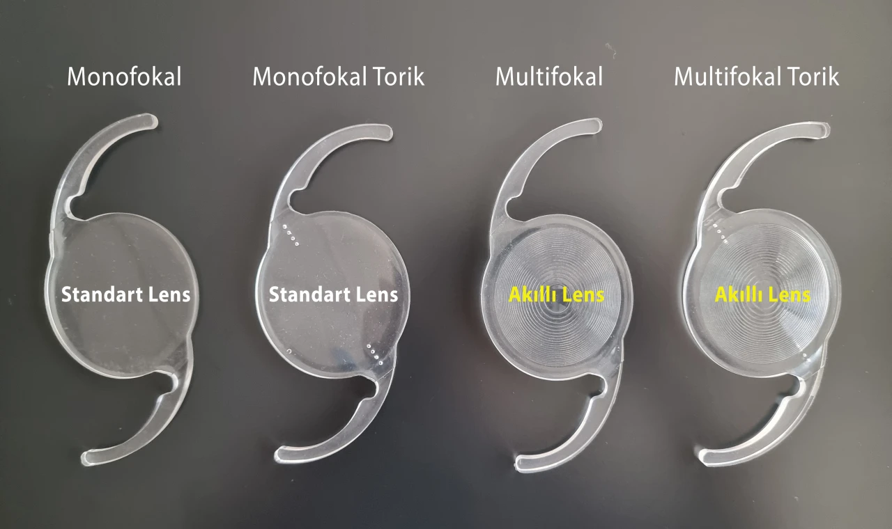 Göz İçi Lensler (Mercekler)