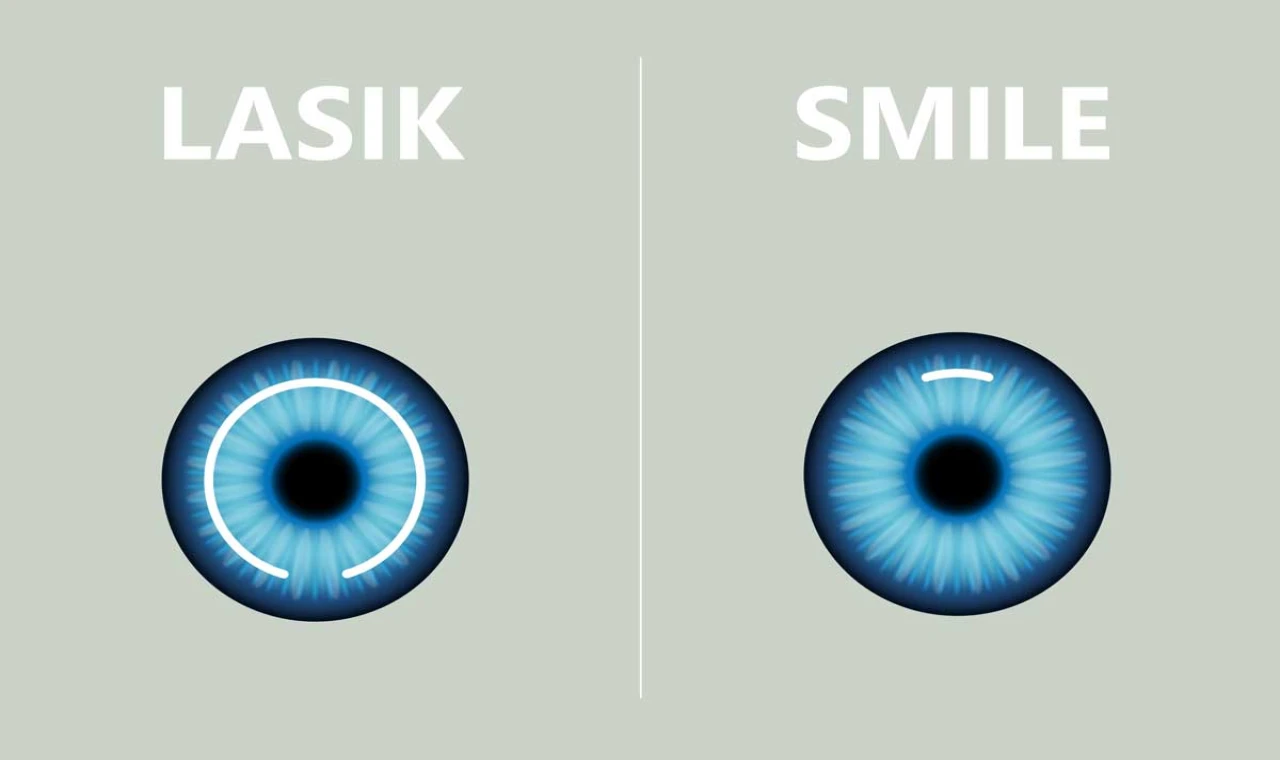 Smile Lazer: Mitler Ve Gerçekler