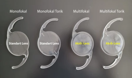 Göz İçi Lensler (Mercekler)