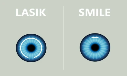 Smile Lazer: Mitler Ve Gerçekler