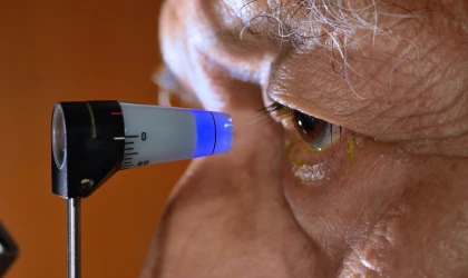 Göz Tansiyonu Tanısında Kontakt Lens Geliştirilmesine Yönelik Bilimsel Çalışma