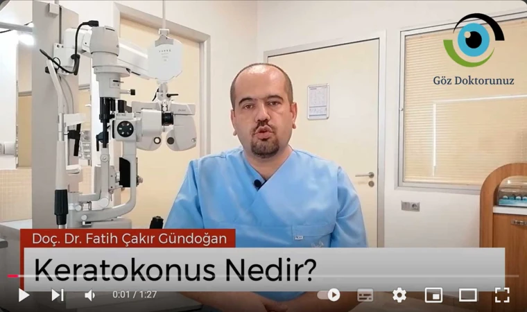 Keratokonus
